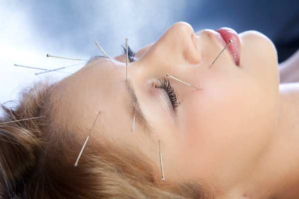 acupuntura facial para rejuvenecer